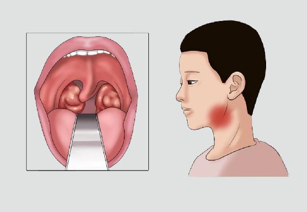 女性常穿收腹内衣好吗